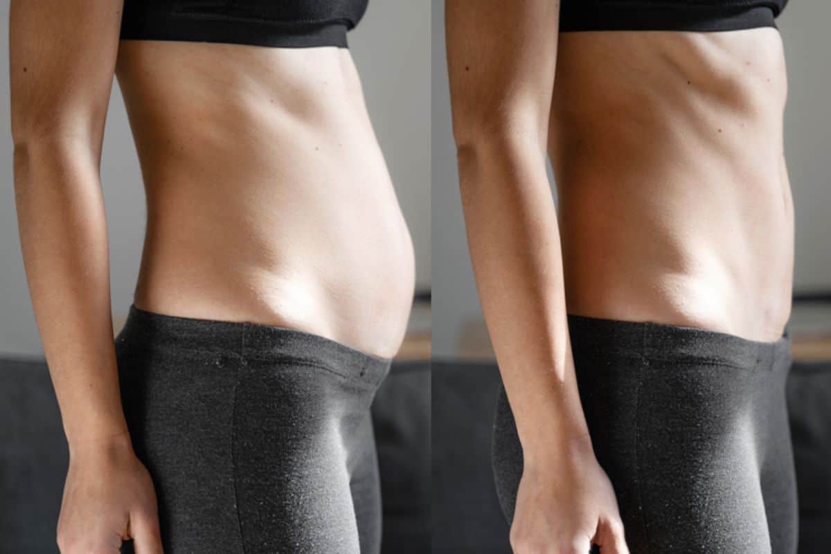 Post-Pregnancy: What Happens to Your Abdominal Muscles After Birth Greater London (Bexley)