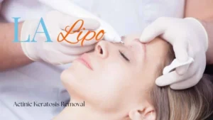 Woman receiving Actinic Keratosis Removal Treatment Greater London (Bexley)