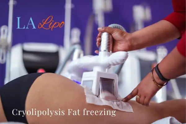 women getting fat freezing Greater London (Bexley)