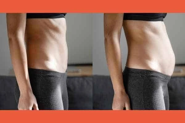 LA-EMS Body Sculpting results Greater London (Bexley)