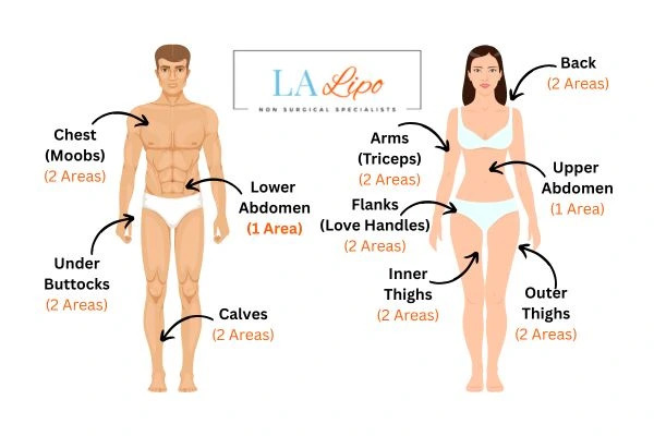 LA LIPO Cryolipolysis Areas Greater London (Bexley)
