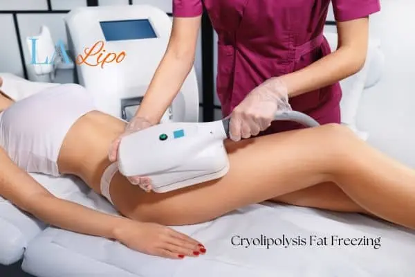 Woman receiving coolsculpting Greater London (Bexley) treatment on her thighs