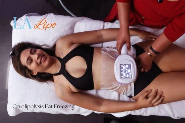 woman getting cryolipolysis Greater London (Bexley)