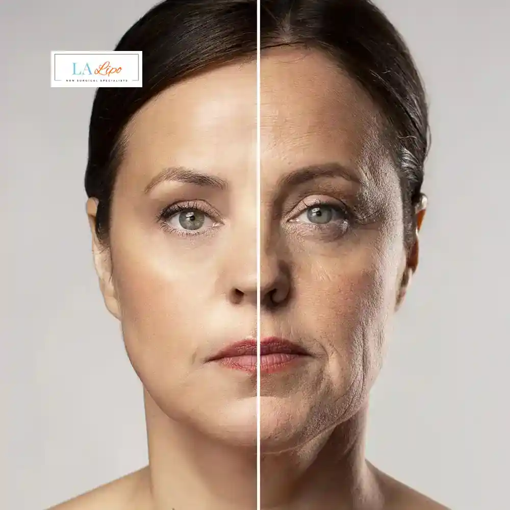 How Can You Tell If Non-Surgical Skin Tightening Is Right for You Greater London (Bexley)?