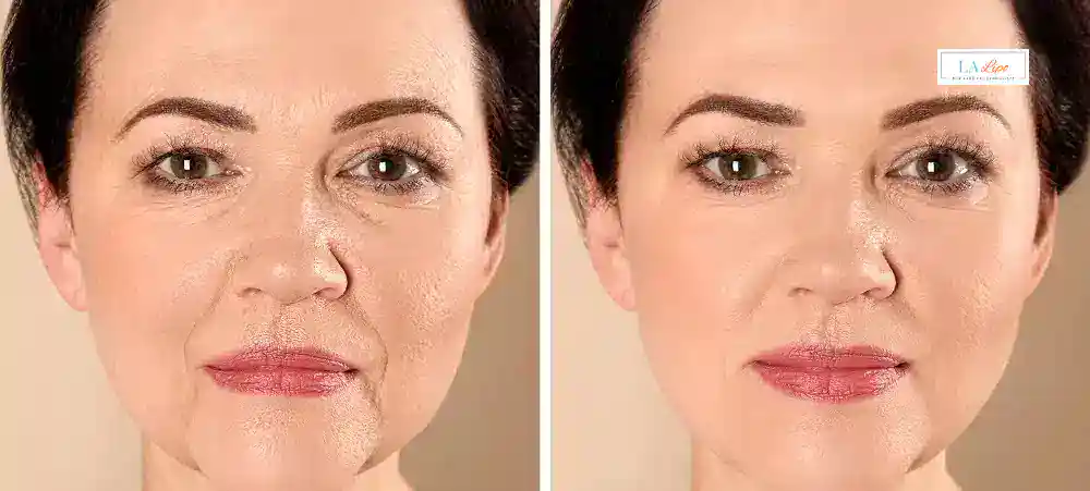 Why Aren’t My Skincare Products Making My Sagging Skin Look Firmer Greater London (Bexley)?