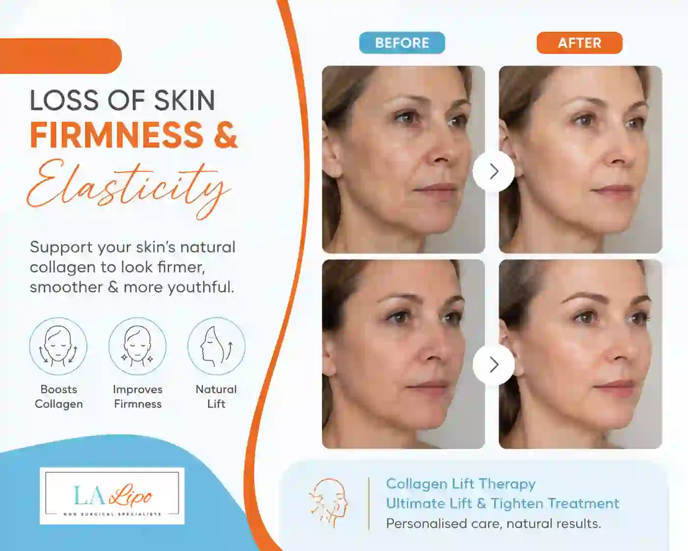 Sign #7: Loss of Skin Firmness and Elasticity Greater London (Bexley)