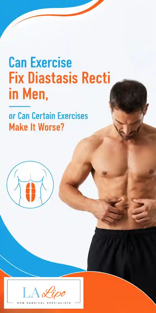 Can Exercise Fix Diastasis Recti in Men, or Can Certain Exercises Make It Worse Greater London (Bexley)?
